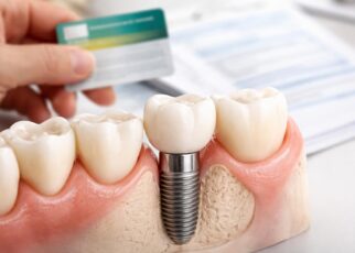 découvrez comment l'assurance maladie et les mutuelles prennent en charge les remboursements pour un implant dentaire, afin de mieux comprendre vos droits et faciliter vos démarches.