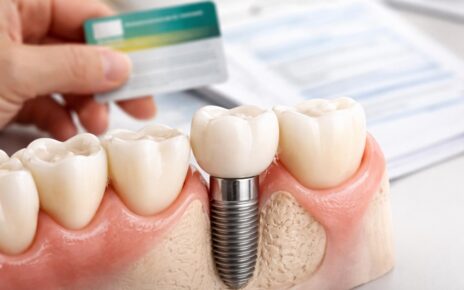 découvrez comment l'assurance maladie et les mutuelles prennent en charge les remboursements pour un implant dentaire, afin de mieux comprendre vos droits et faciliter vos démarches.